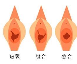 运城妇科医院