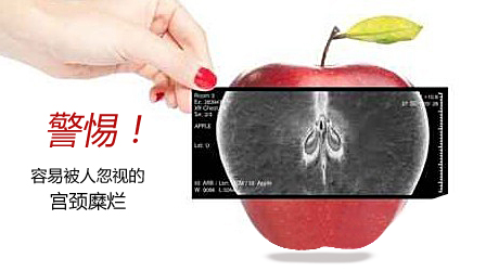 运城治疗宫颈糜烂医院