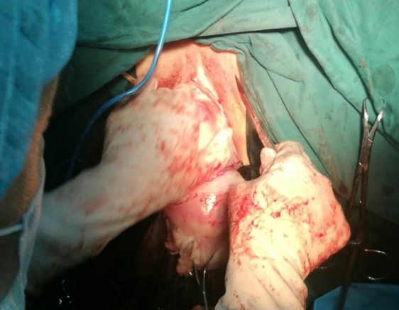 运城现代妇科医院