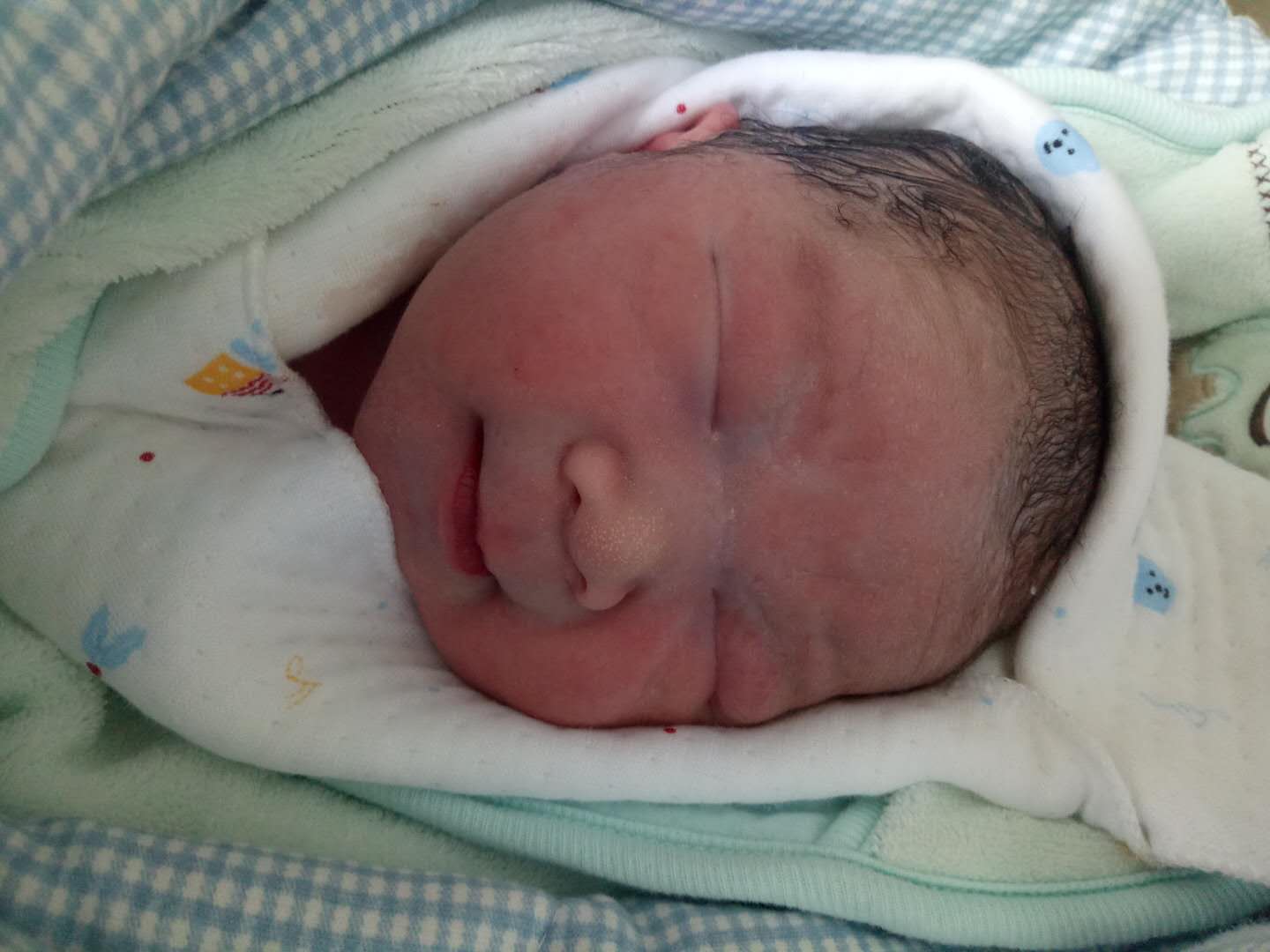 【喜报】运城现代剖宫产顺利诞下麟儿